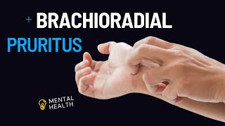 Living with Brachioradial Pruritus Managing the Itch and Discomfort [upl. by Odnanref]