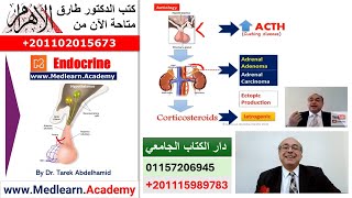 Cushing Syndrome cme internalmedicine usmle medical محاضراتباطنة [upl. by Lexi]