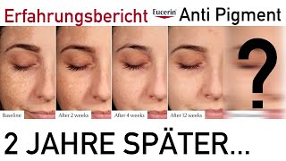 Pigmentflecken Update nach 2 Jahren Eucerin AntiPigment   Emotionale Story Haut blutig weggeätzt [upl. by Aggarwal]