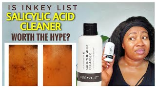 Dr V Approved INKEY LIST 2 SALICYLIC ACID Cleanser REVIEW [upl. by Oconnor817]