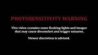 Photosensitivity Warning  This video contains some flashing lights and images ⚠️ [upl. by Lydell]