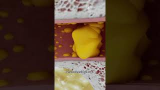 How to Remove Ear Wax Blockage the Right Way shorts facts  creativelearning3d [upl. by Ytok]