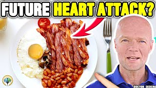 Is CHOLESTEROL BAD For You Real Doctor Reviews The TRUTH [upl. by Thorvald]