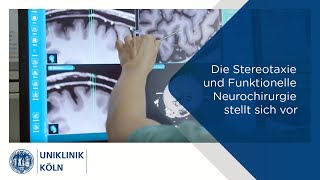 Die Stereotaxie und Funktionelle Neurochirurgie stellt sich vor  Uniklinik Köln [upl. by Dadirac569]