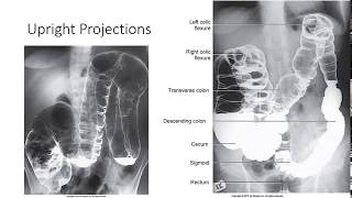 Radiographic Positioning of the Large Intestine [upl. by Childers]