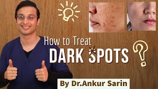 How To Lighten Dark Underarms at Home  Get Rid of Dark Armpits Naturally [upl. by Adehsar]