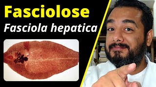 Fasciolose Fasciola hepatica o que é ciclo sintomas diagnóstico  Curso de Parasitologia [upl. by Dimo]