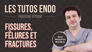 Benjamin Boublil EP3  Fissures fêlures fractures [upl. by Latton850]