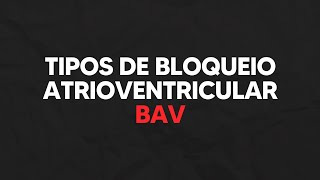 Tipos de bloqueio atrioventricular  BAV [upl. by Peyter]