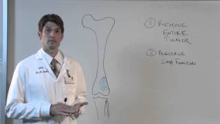 Limb Salvage Surgery for Bone Sarcoma  Ben Miller MD [upl. by Garner320]