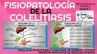 COLELITIASIS FISIOPATOLOGÍA GuiaMed [upl. by Nappie]