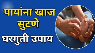 पायांना खाज सुटणे घरगुती उपाय  payana khaj sutane  Itching Feet  Health Tips [upl. by Evander]