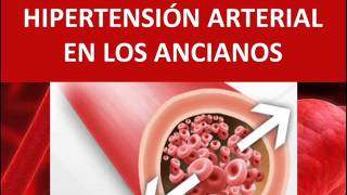 Hipertensión arterial en los ancianos [upl. by Etteneg]