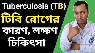 Tuberculosis TB টিবি রোগের লক্ষণ কি কি  Tuberculosis Infection in Bengali  Tuberculosis Test [upl. by Mercer]