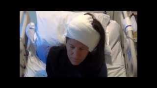 GBM Brain Tumor Surgery Survivor [upl. by Rudich]