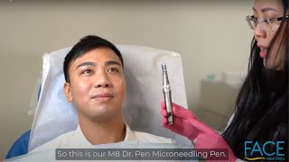 How to Use M8 Microneedling Dr Pen [upl. by Ayrb]