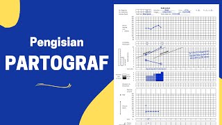 Pengisian Lembar Partograf dan Contoh Pengerjaan Soal Partograf [upl. by Santa]