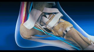 Endoscopic FHL Transfer for Achilles Tendon Ruptures [upl. by Rialb]