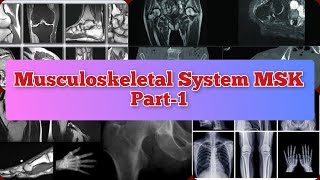 Radiology Viva Cases  7173  Musculoskeletal System Part1  MSK medical radiology ultrasound [upl. by Fadas20]