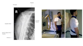 Shoulder XRay  AP YView [upl. by Serena]