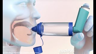 How to Use a Metered Dose Inhaler with a Spacer [upl. by Romalda]