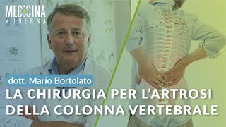 La chirurgia per lartrosi della colonna vertebrale  Dott Mario Bortolato [upl. by Landis541]