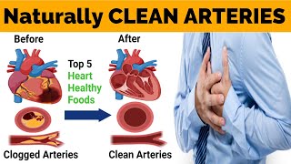 Foods to Unclogging Arteries Naturally and Prevent Heart Attack [upl. by Kovar]