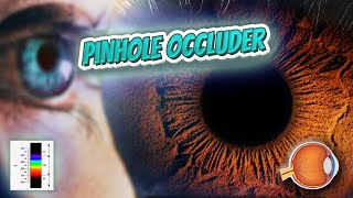 Pinhole occluder  Your EYEBALLS  EYNTK 👁️👁️💉😳💊🔊💯✅ [upl. by Maleen]