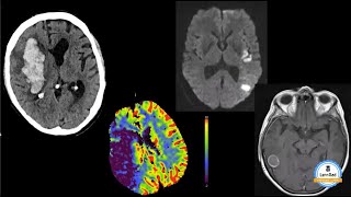 Lernrad Neuroradiologie Basics Kurs  Lust auf Fallbasiertes interaktives Lernen [upl. by Harriett263]