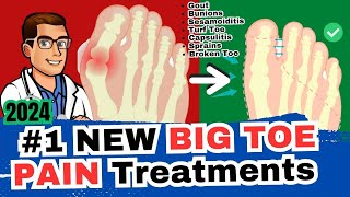 1 Big Toe Joint Pain Cure Arthritis Sesamoiditis Turf Toe Gout [upl. by Lugar]