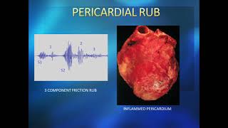 How to differentiate between pericardial and pleural friction rub  MEDINCINE with DR SHAMAMA [upl. by Geffner647]