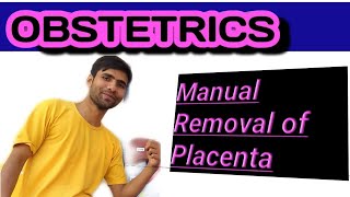 Manual Removal of Placenta By Vivekanand Mishra [upl. by Warila]