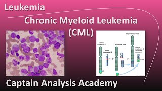 E5 Chronic myeloid leukemia CML Philadelphia chromosome سرطان الدم الميلودى النخاعى المزمن [upl. by Brouwer574]