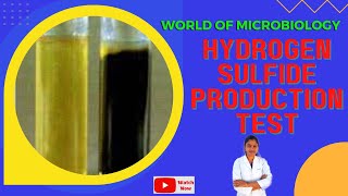 Hydrogen Sulfide Production Test Tamil  Biochemical Test  SIM Sulfide Indole MotilityMedium [upl. by Sherj]