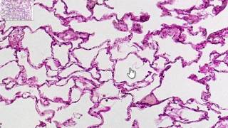 Respiratory System 4 Alveoli and gaseous exchange [upl. by Lamrert]