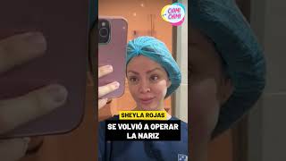 Sheyla Rojas emocionada tras someterse a una tercera rinoplastia [upl. by Griffin]