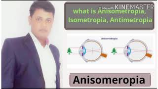 Anisometropia  Isometropia  Antimetropia  Simple  Compound  Mixed anisometropia  treatment [upl. by Anileh]