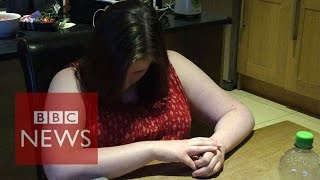 Narcolepsy What is it like to have a cataplexy attack  BBC News [upl. by Hoyt]