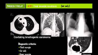 Chest X ray  Dr Mamdouh Mahfouz [upl. by Niassuh]