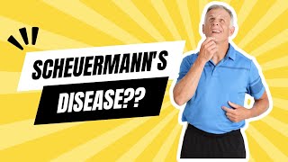 What is Scheuermanns Disease [upl. by Talanian801]