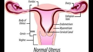 Pathology of Endometrium and Myometrium Pathoma Lectures word by word explained [upl. by Anika]