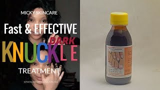 Fade Off Dark Knuckles Fast amp Effective  Fongicide Natural Light  Dark Knuckles Treatment [upl. by Eimaj]