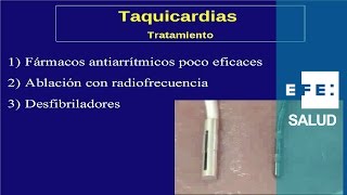 Tratamiento de las arritmias de taquicardia fármacos ablación y desfibrilador [upl. by Maguire]