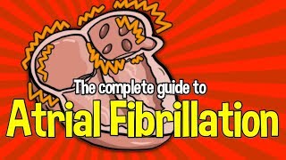 Complete Guide To Atrial Fibrillation Causes symptoms and treatments [upl. by Enoyrt685]