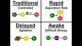 Introduction to Intubation  01  Approach Sequence [upl. by Trilby]