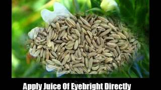 8 Natural Cures For Glaucoma [upl. by Relyuhcs396]