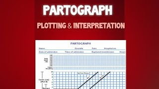 Plotting and Interpretation of Partograph [upl. by Okwu]