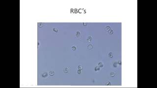 Microscopic Urinalysis [upl. by Rogerg]