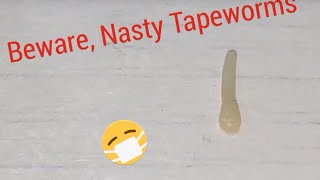 REAL MOVING TAPEWORM informative Video [upl. by Harv940]