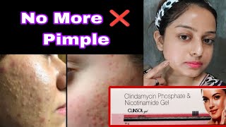 clinsolgel clindamycin phosphate nicotinamide gel review  pimple marks removal cream clinsolcream [upl. by Onaicul]